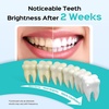 image:imageCOSLUS ADA Accepted C20 Water Dental Flosser Teeth Pick 300ML Larger Tank  Portable Rechargeable Oral Irrigator for Orthodontic amp Sensitive Gums Cordless for Travel Family Whitening Set BlackBlack